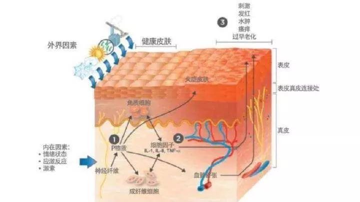 齊齊哈爾市“屏障修復(fù)”修復(fù)的是什么？不同膚質(zhì)該如何搭配？